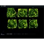 Magzat 3DXI képe - MySono U6