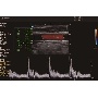 CCA Doppler kép QuickScannel optimalizálva